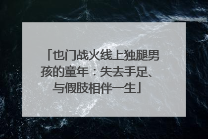 也门战火线上独腿男孩的童年：失去手足、与假肢相伴一生